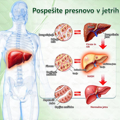 💥Registrirano pri JAZMP in GMP certificirano👩‍⚕️🎁 𝐆𝐞𝑒𝐿𝑒𝐦𝐨𝐧® 𝐆𝐥𝐮𝐦𝐚𝐬𝐞𝐭𝐢𝐝𝐞 8 v 1 Hujševalni in zdravju namenjen nano obliž z mikroiglicami 🇸🇮 (Samo enkrat na dan, vidne spremembe že v 7 dneh) ✅