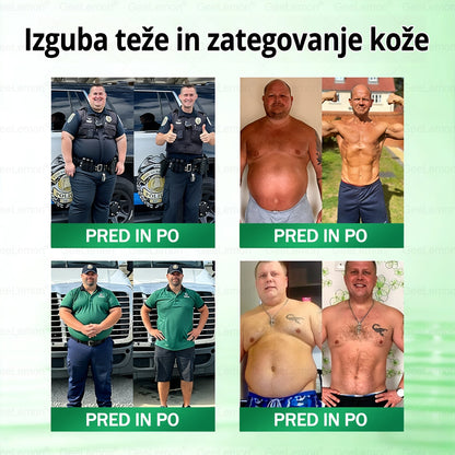 💥Registrirano pri JAZMP in GMP certificirano👩‍⚕️🎁 𝐆𝐞𝑒𝐿𝑒𝐦𝐨𝐧® 𝐆𝐥𝐮𝐦𝐚𝐬𝐞𝐭𝐢𝐝𝐞 8 v 1 Hujševalni in zdravju namenjen nano obliž z mikroiglicami 🇸🇮 (Samo enkrat na dan, vidne spremembe že v 7 dneh) ✅