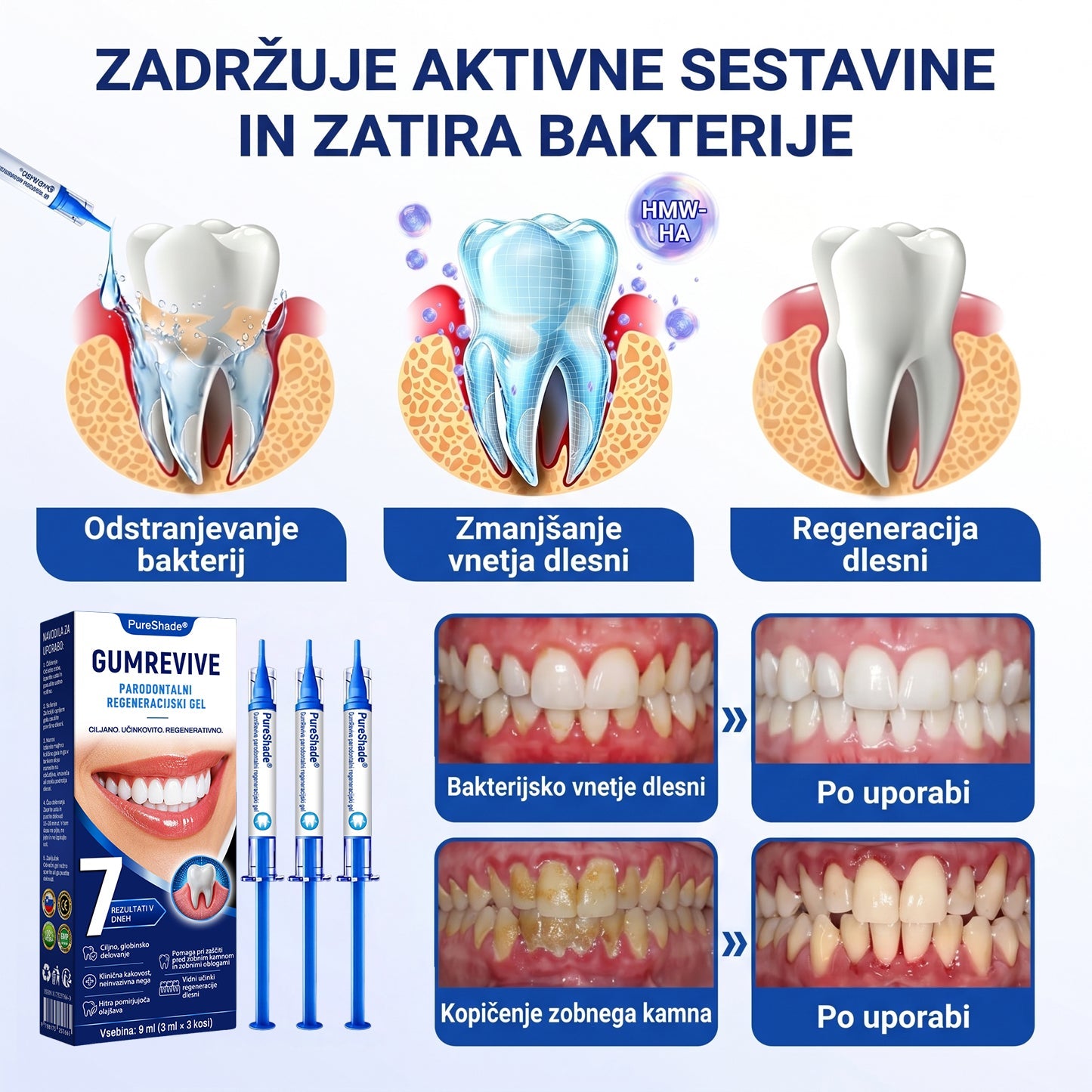 Prelomna klinična rešitev za regeneracijo ustne votline 👨‍⚕️🦷 PureShade® GumRevive regeneracijski gel za obzobna tkiva 🎁