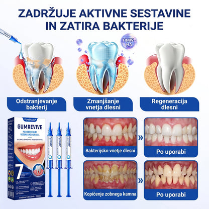 Prelomna klinična rešitev za regeneracijo ustne votline 👨‍⚕️🦷 PureShade® GumRevive regeneracijski gel za obzobna tkiva 🎁